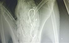 Rare albatross makes remarkable recovery after swallowing multiple fishing hooks